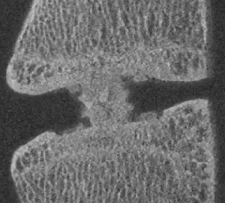 Reef Topography macro surface profile engineered for interbody fusion stability