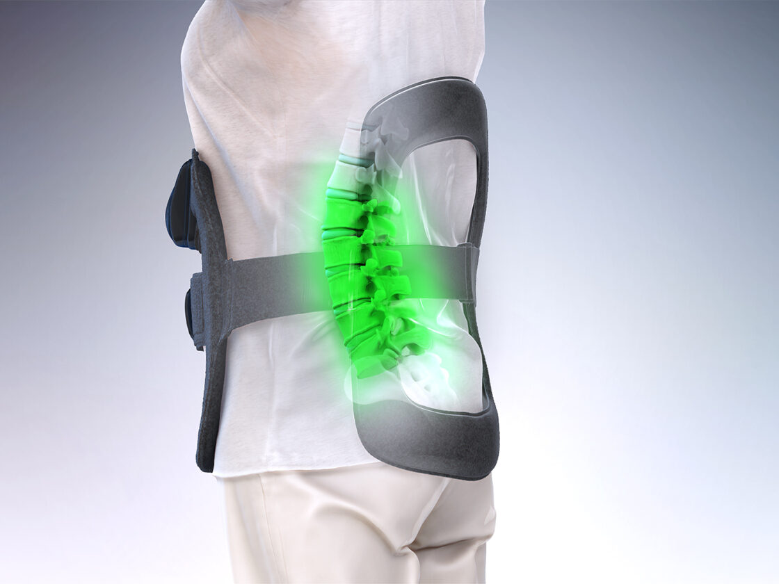 Bone Growth Stimulation Devices and Pulsed Electromagnetic Field Therapy