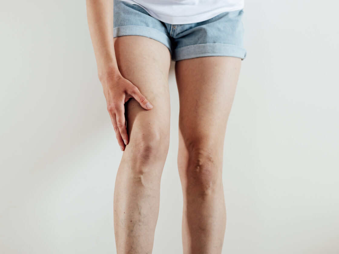 Limb Healing and Extremity Reconstruction Solutions