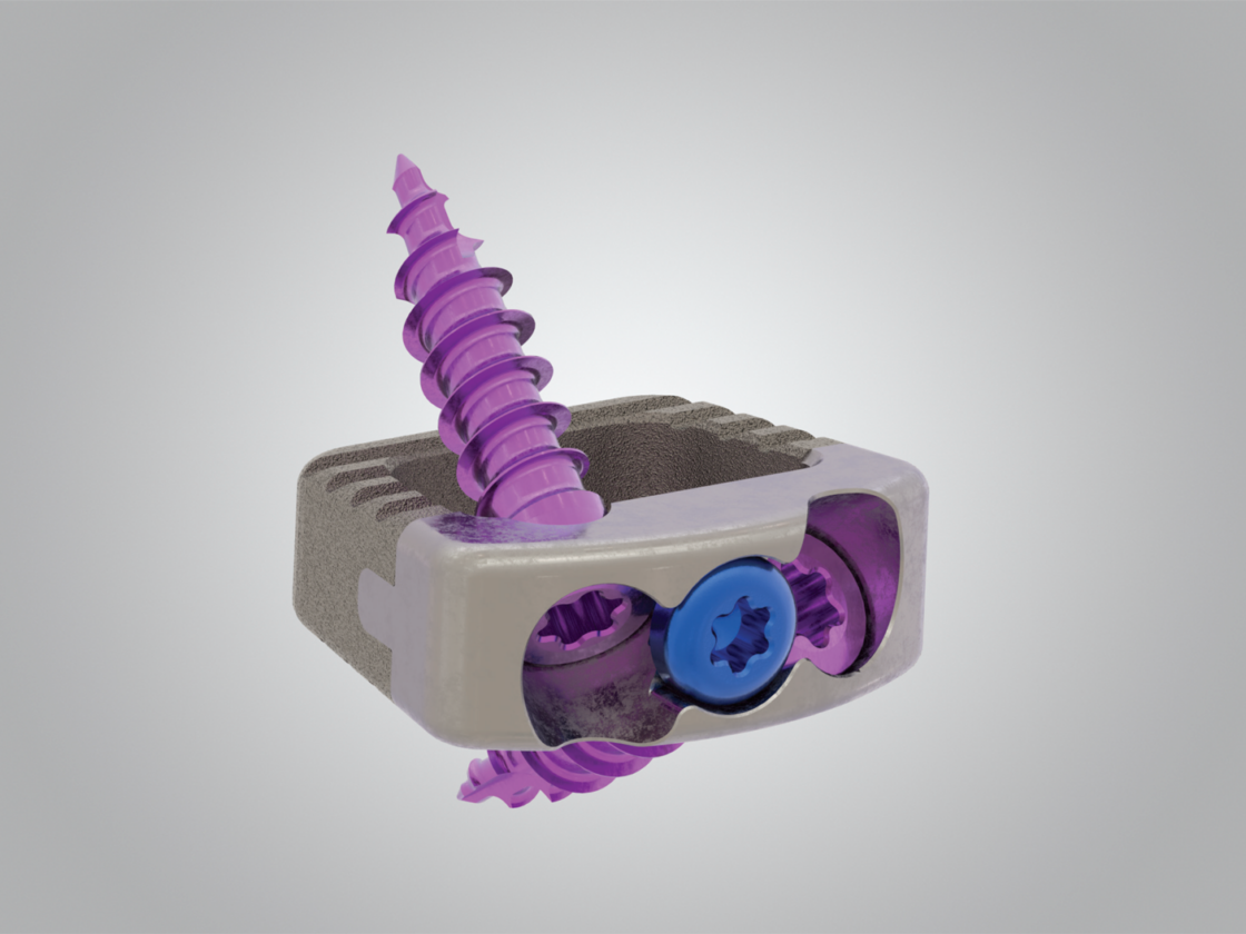 Anterior Cervical Fixation System for spine fusion