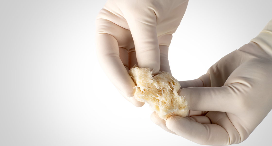 Accell Evo3 Demineralized Bone Matrix with enhanced graft containment