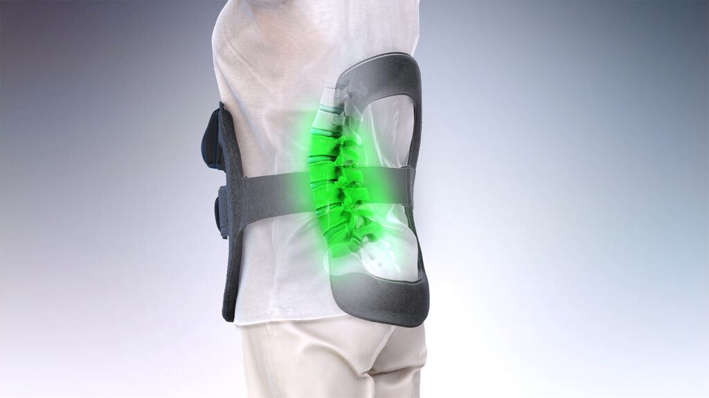 SpinalStim Pulsed Electromagnetic Field therapy device