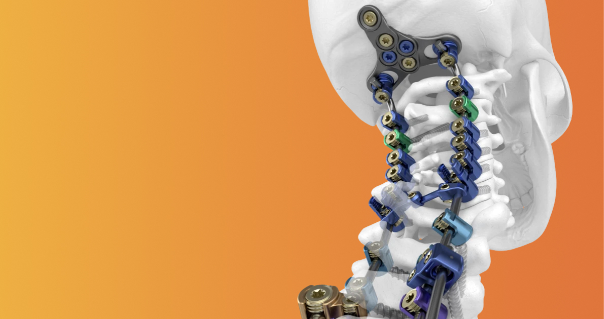 Orthofix spinal surgical procedures and interbody instrumentation system